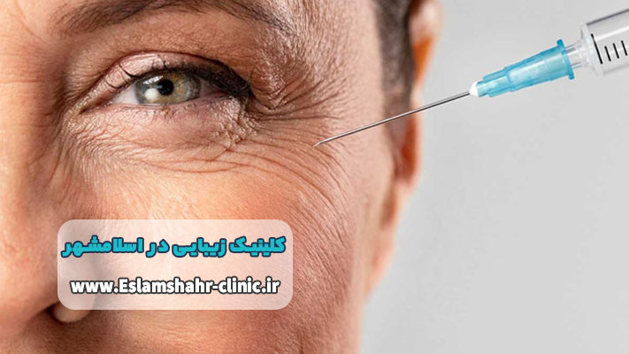 تزریقات زیبایی برای رفع چینوچروک و فرمدهی صورت در کلینیک زیبایی اسلامشهر